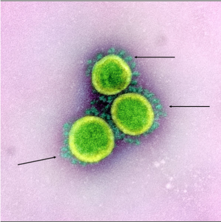 Coronavirus Spikes